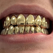 10k Gold Grillz - Gold Teeth Master