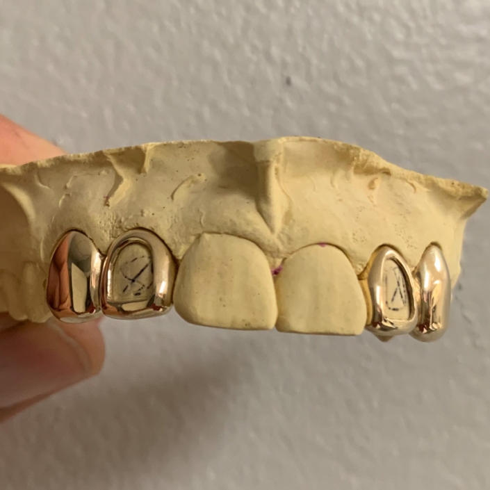 10K Solid Gold 4 Top or 4 Bottom - Gold Teeth Master