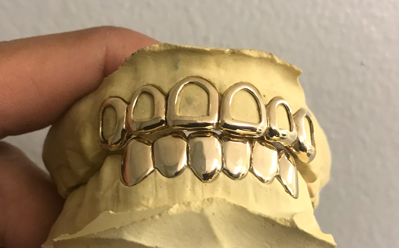 10K SOLID GOLD 6 TOP & 6 BOTTOM - Gold Teeth Master