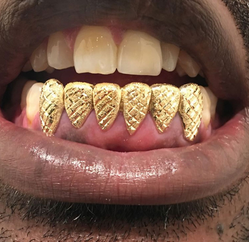 10K Solid Gold 6 Top or 6 Bottom - Gold Teeth Master
