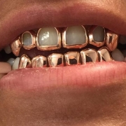 10K SOLID GOLD 6 TOP & 6 BOTTOM - Gold Teeth Master