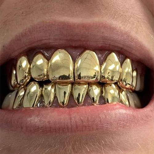 10K Solid Gold 8 Top & 8 Bottom - Gold Teeth Master