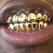 10K Solid Gold 8 Top & 8 Bottom - Gold Teeth Master