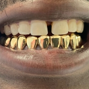 Home - Gold Teeth Master