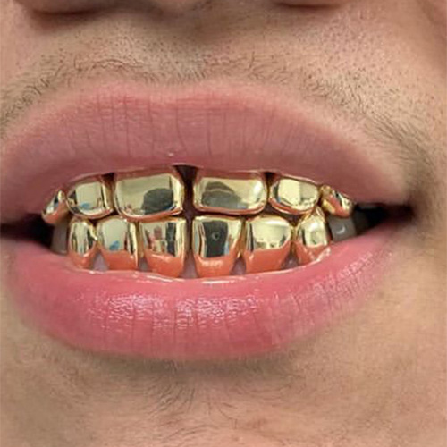gold teeth grillz