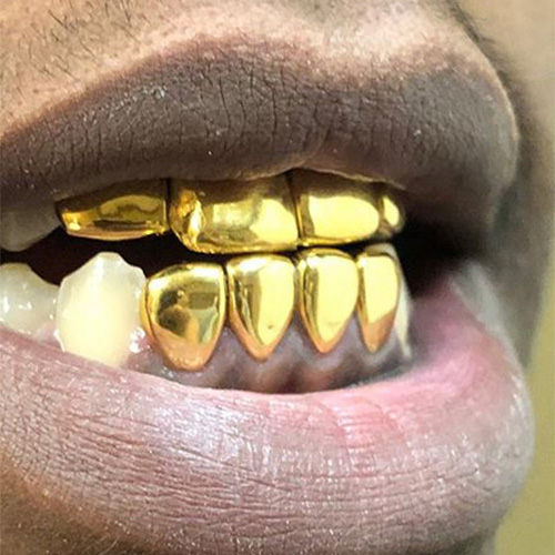 22k Gold Grillz - Gold Teeth Master